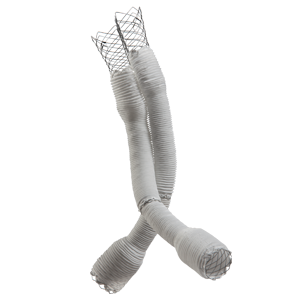 Altura? Endograft System